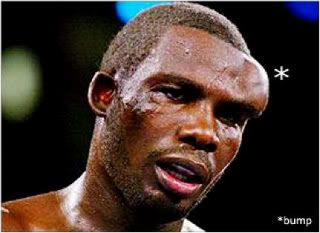 Name:  bump6sq-1.jpg
Views: 54
Size:  17.3 KB